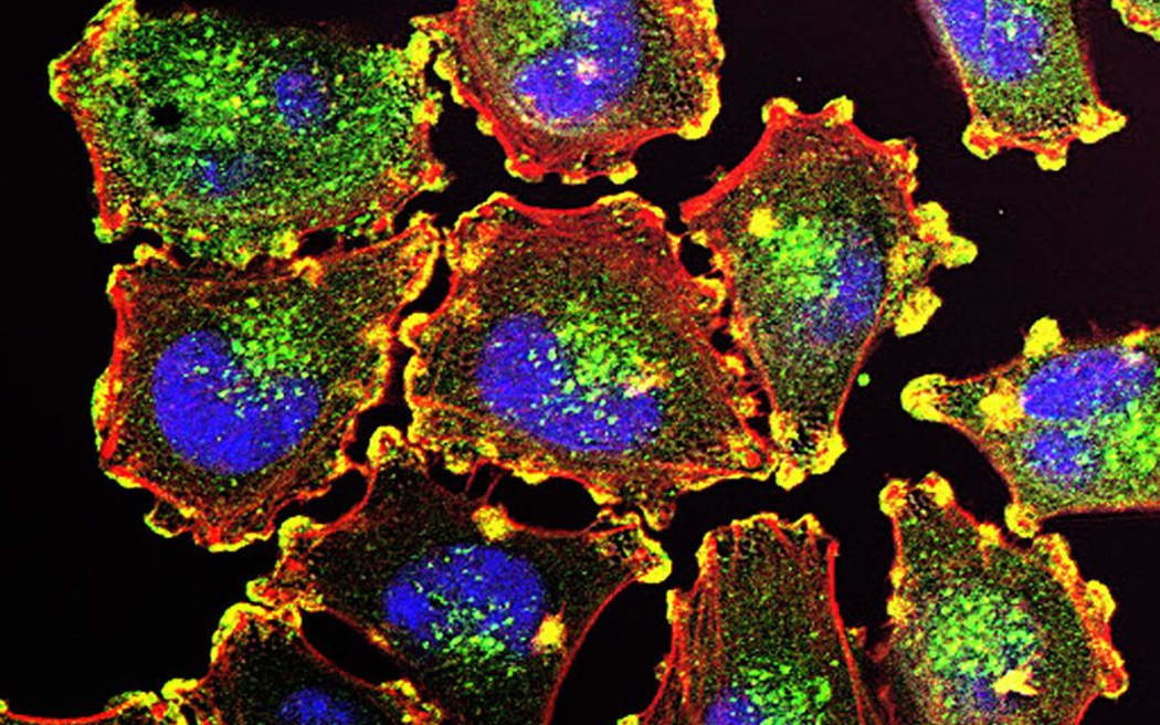 Molecular basis for melanoma cell motility