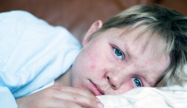 South Carolina measles outbreak surges to 211 cases after holidays