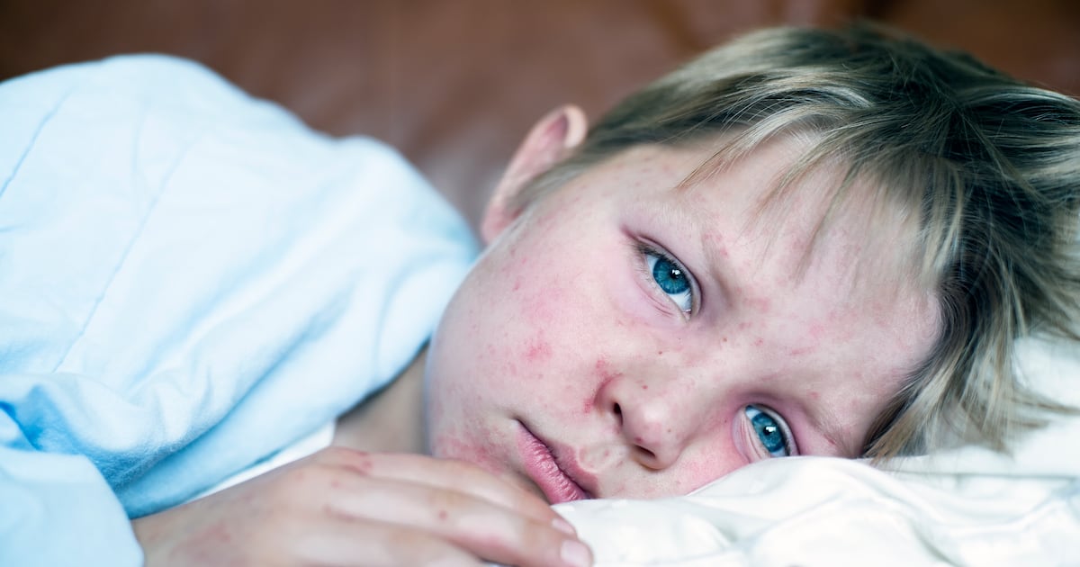 South Carolina measles outbreak surges to 211 cases after holidays