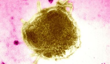 Oregon Health Authority confirms first measles case of 2026 | Top Stories