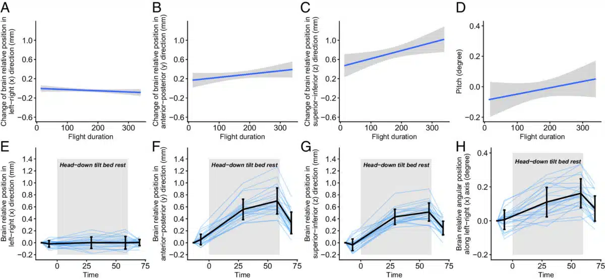 Brain Position Shifts With Flight Duration And During Head Down Tilt Bed Rest, Shown Across Spatial Axes And Rotation.