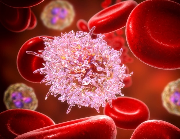 Minimally invasive biopsy enables real-time tracking of amyloid disease progression