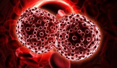 New study exposes a targetable vulnerability in acute myeloid leukemia