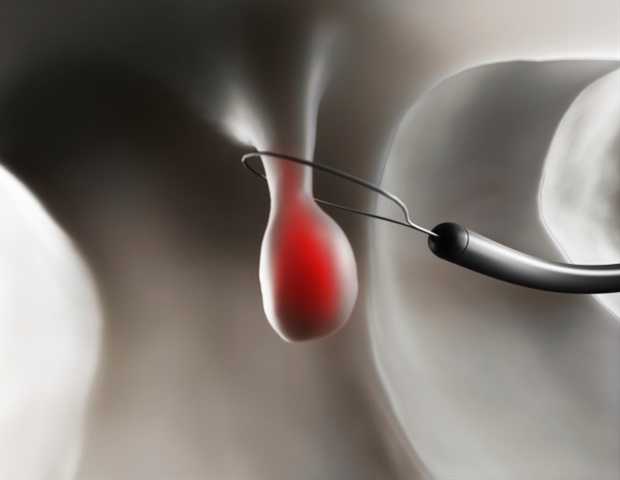 Bowel preparation for colonoscopies may temporarily alter gut balance, preclinical study suggests