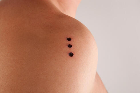 the rise of Kambo frog venom ceremonies