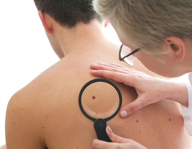 Treating desmoplastic melanoma with immunotherapy before surgery can shrink or eliminate tumors
