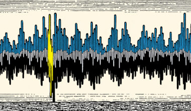 Non-invasive sound therapy shows promise for Alzheimer’s