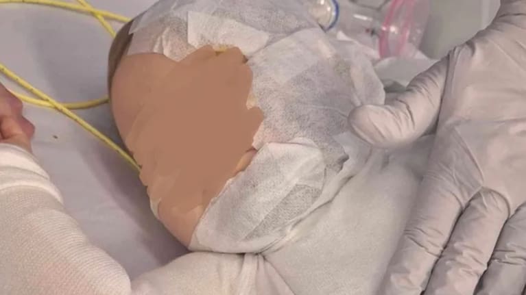 A baby injured after hot coffee was poured on him in Brisbane.