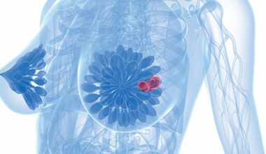 Epcoritamab did not demonstrate a significant improvement in OS, but improvements were observed in PFS, ORR, and DOR in this DLBCL group.