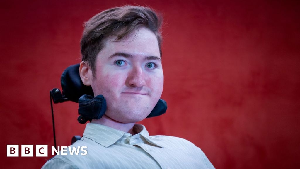 Jessy Nelson spoke about SMA this week