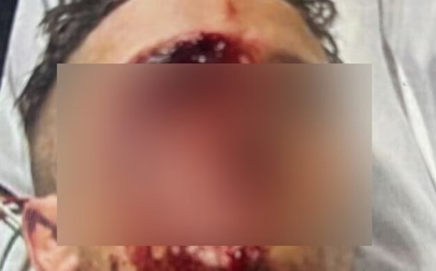 Shane Khan ordered to serve full jail term after baseball bat attack on mate in Hamilton