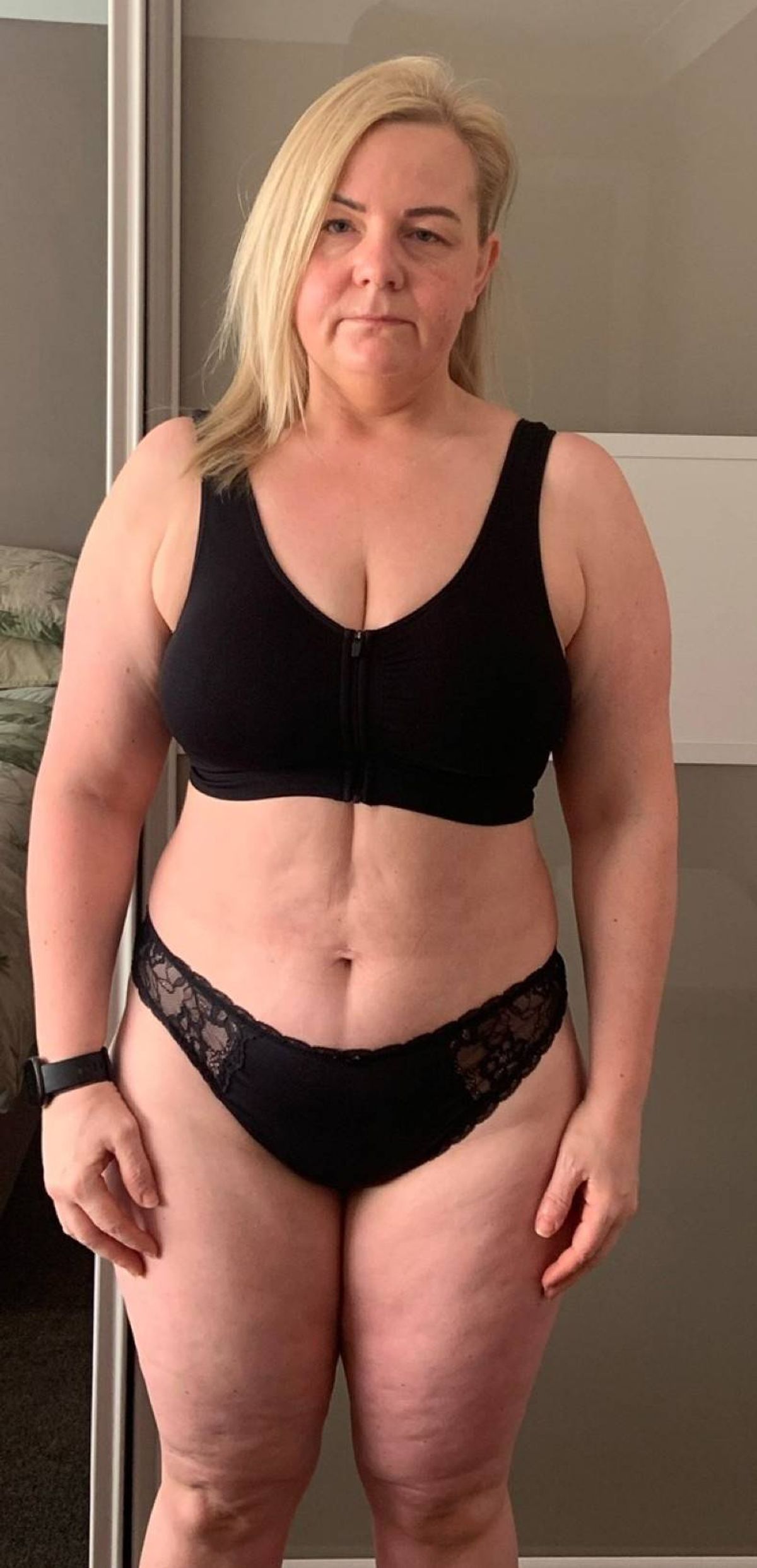 Vicky used to have an obese BMI