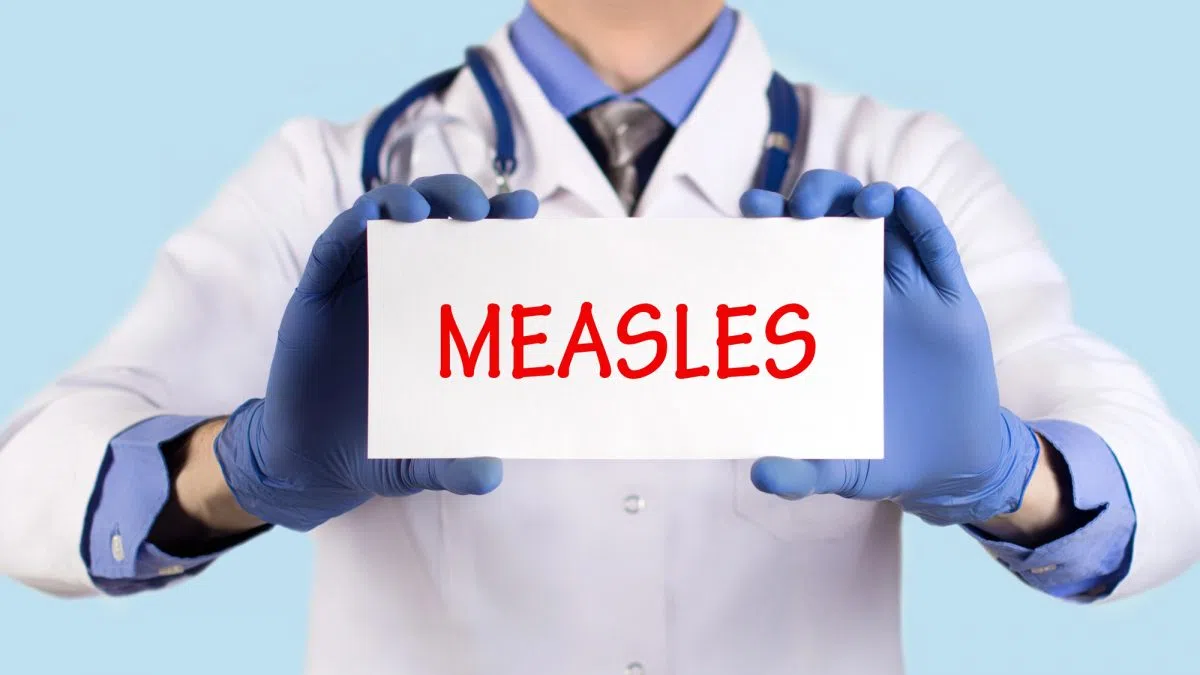 Southeast Public Health investigating exposures to a confirmed measles case
