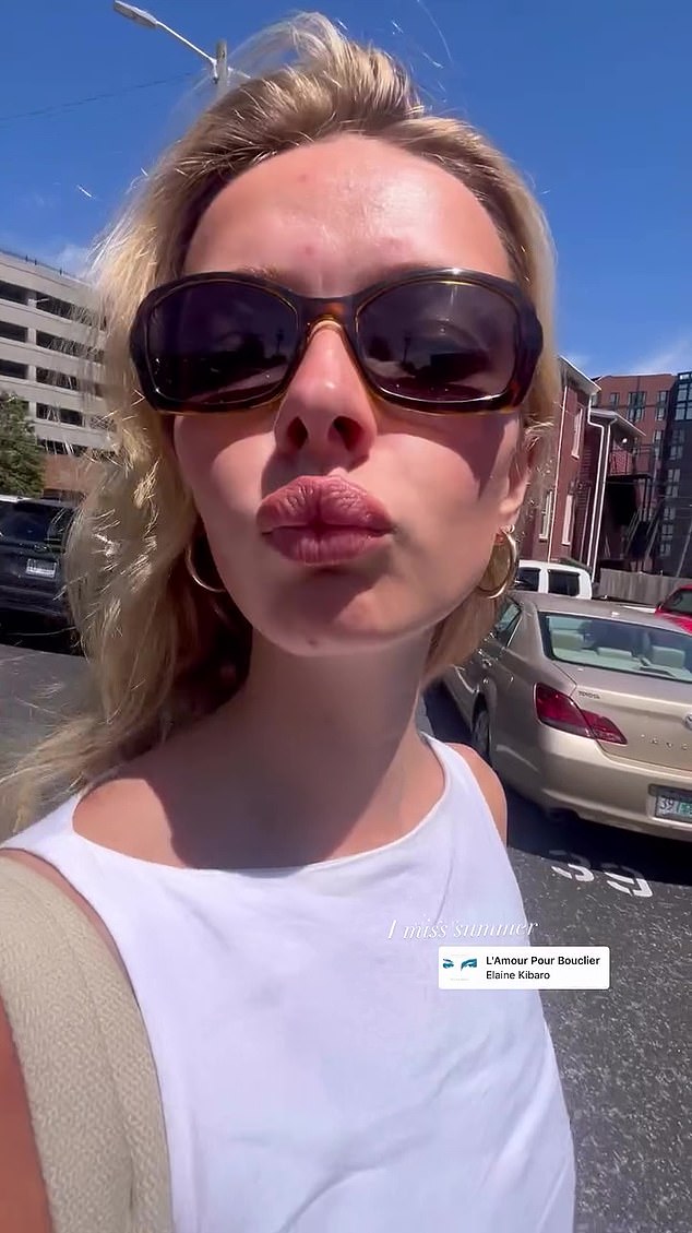 Seen last month on Instagram. She told Vogue that once she got lip filler