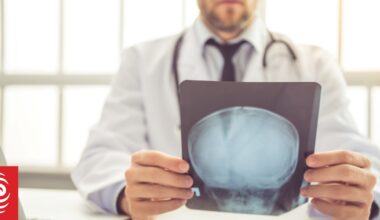 Warning shortage of neurologists will see struggle with demand