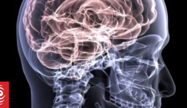 Not just sport and car crashes: debunking 5 myths about traumatic brain injury in NZ