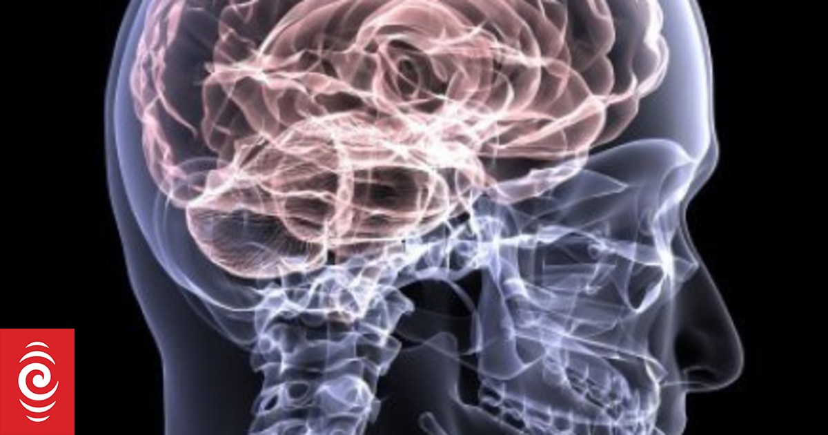 Not just sport and car crashes: debunking 5 myths about traumatic brain injury in NZ