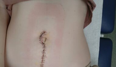 Woman facing organ removal after claimed GP inaction now believes clinic lost med records