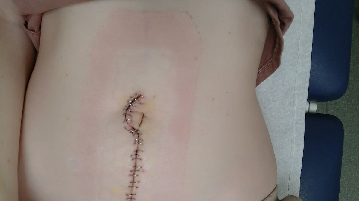 Woman facing organ removal after claimed GP inaction now believes clinic lost med records