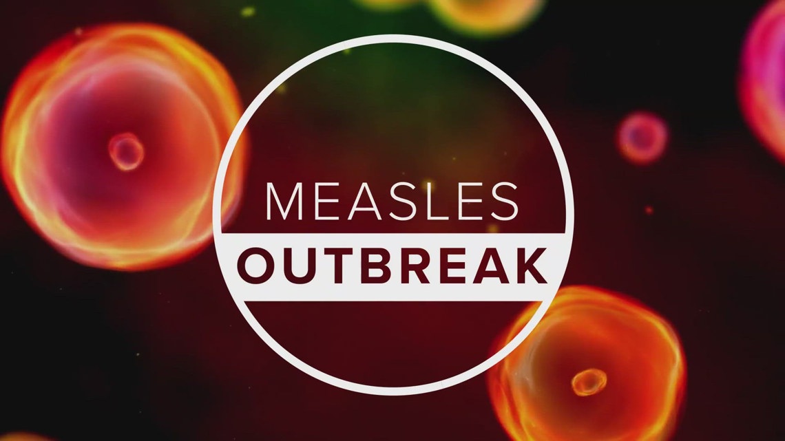 5th measles case of 2026 confirmed in Duval County, Jacksonville's chief health officer says