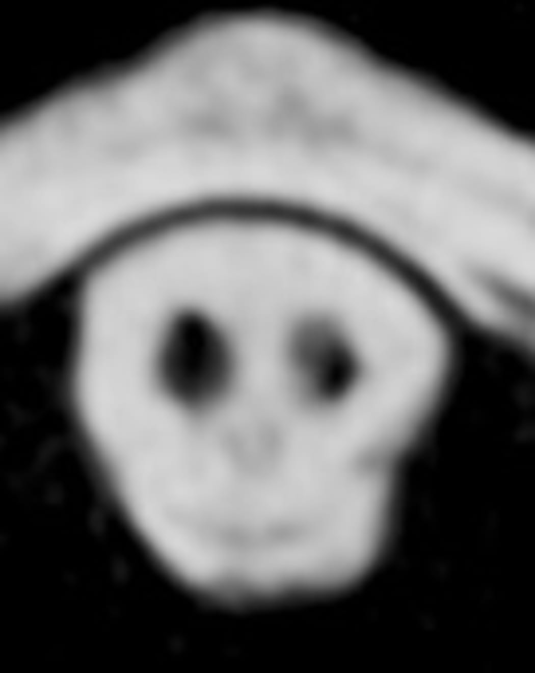 A spooky image described a "grim reaper" has shown up in a medical scan of someone who'd just be in a car accident.