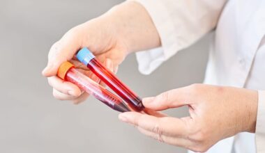 Grail's $700 Blood Test May Detect Cancer Early With 2 Tubes of Blood