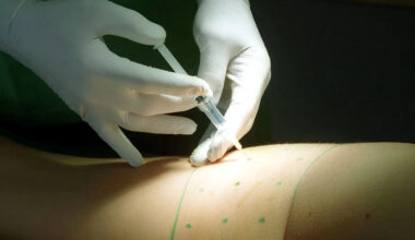 New Technology Allows Plastic Surgeons to Inject Donor Fat from Cadavers