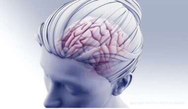 Started within 48 hours of stroke, neuroprotective medication helped brain cells, recovery
