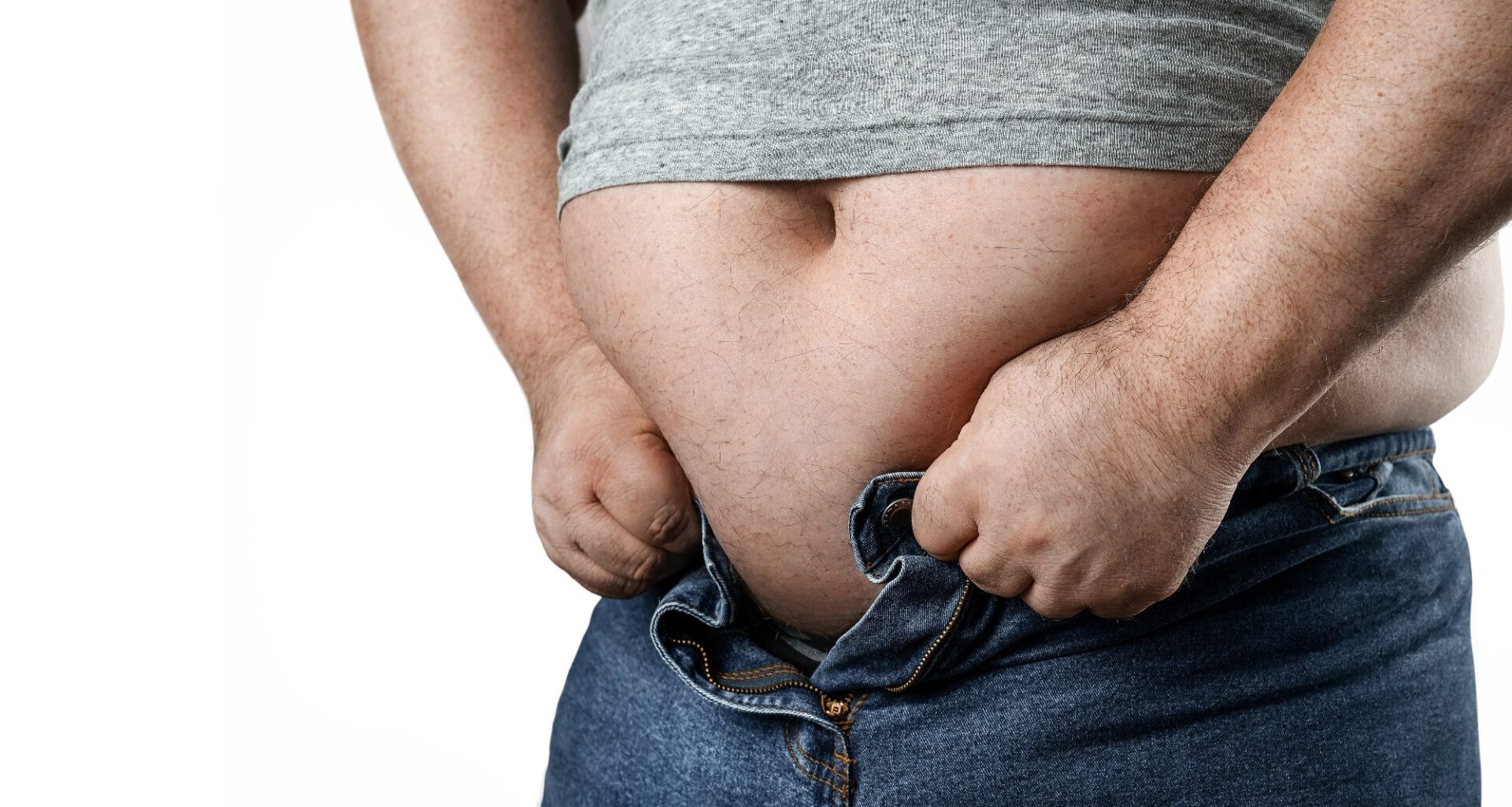 Study: Adult obesity and risk of severe infections: a multicohort study with global burden estimates. Image Credit: rangizzz / Shutterstock