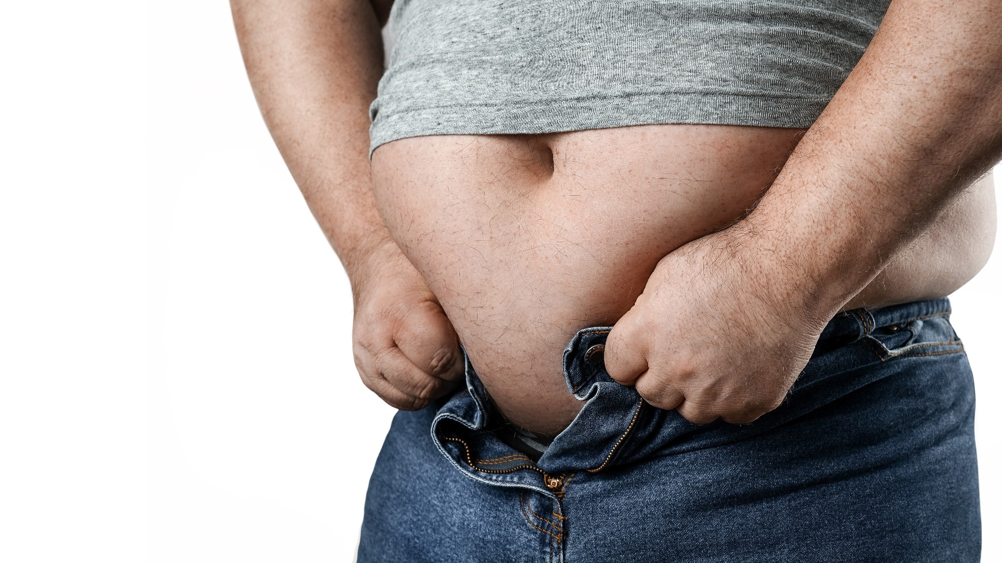 Study: Adult obesity and risk of severe infections: a multicohort study with global burden estimates. Image Credit: rangizzz / Shutterstock