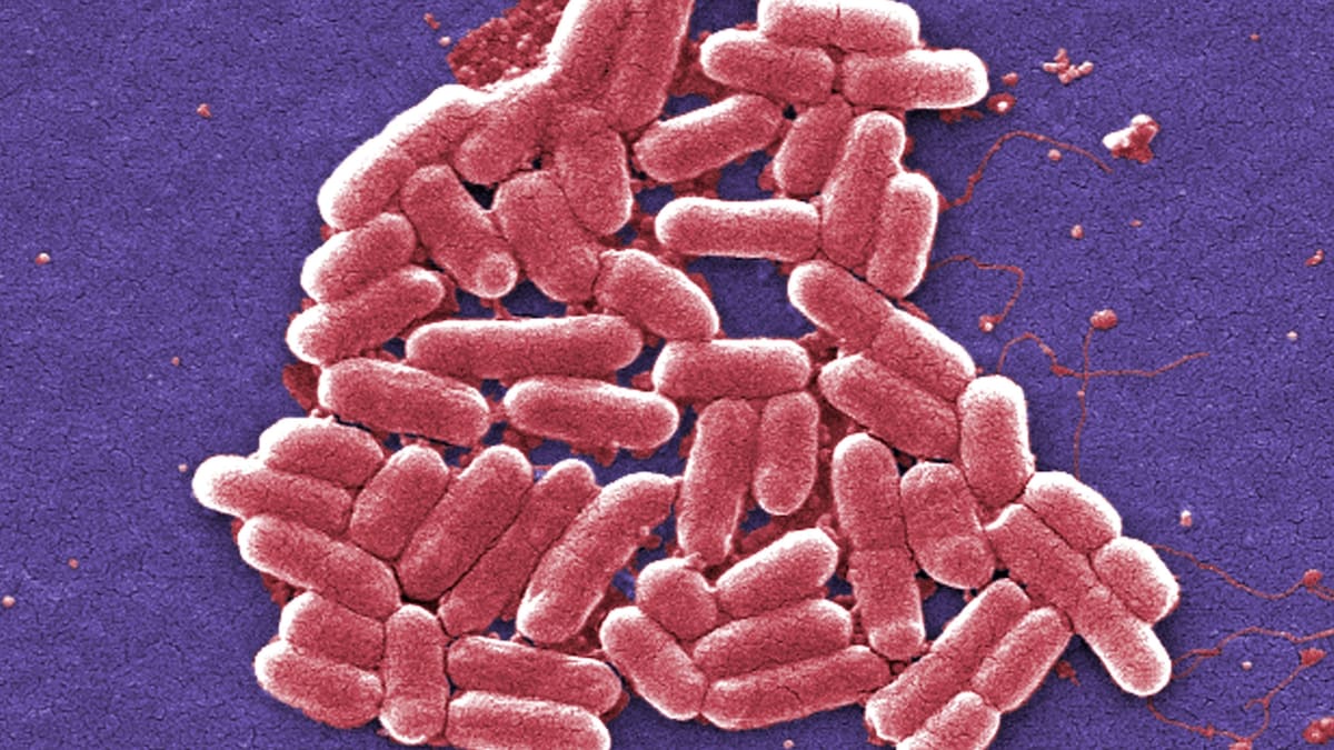 Auckland’s Herald Island under boil water notice after E. coli alert