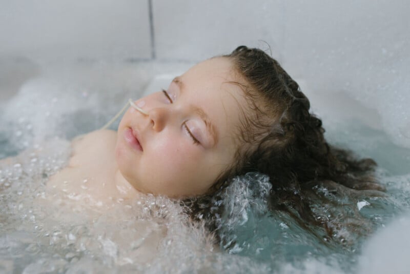 A young child with a nasal tube rests with eyes closed in a bathtub filled with water and bubbles, appearing peaceful and relaxed.