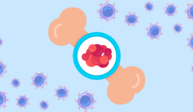 Cancer Drug Reactivates Multiple Myeloma CAR‑T Therapy