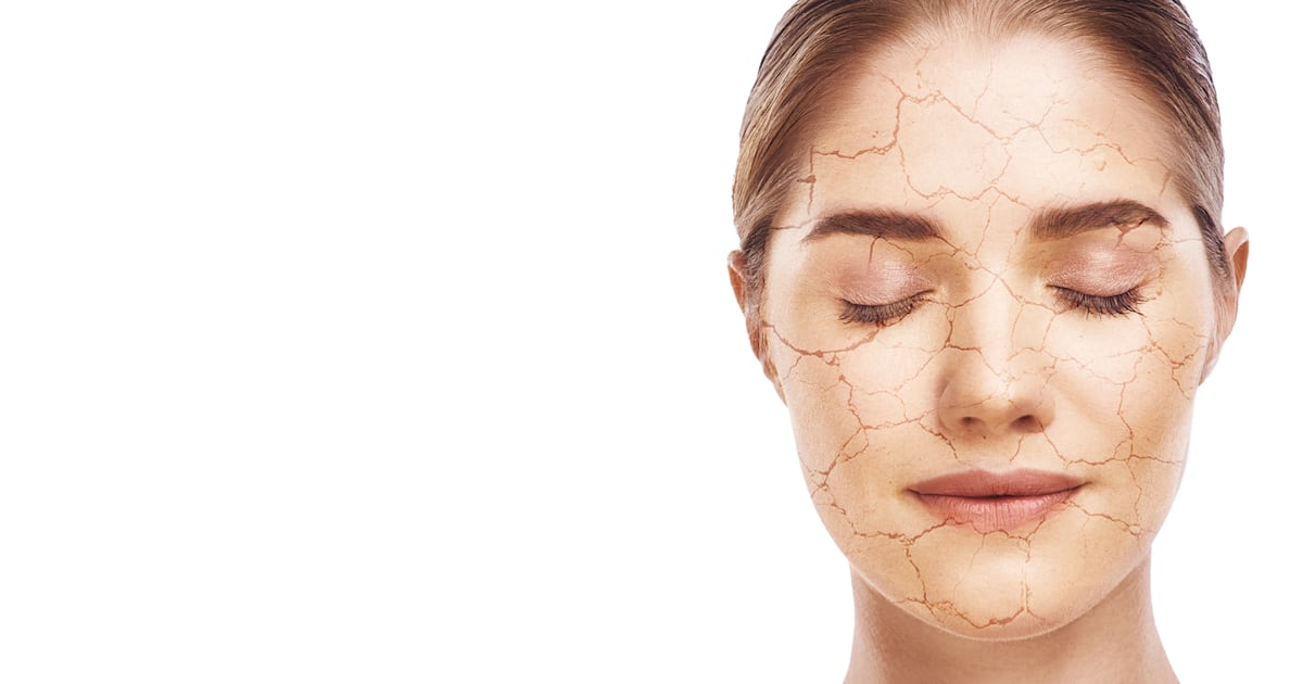 Dry skin linked to systemic lipid imbalance, not simple deficiency
