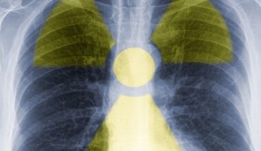 University of Missouri launches first on-campus radiopharmaceutical clinical trial