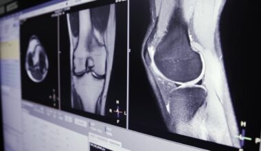 Scientists Just Found a Way to Regrow Cartilage Without Stem Cells, And It Could Change Arthritis Treatment Forever