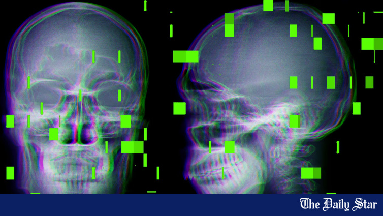 As AI enters the operating room, reports arise of botched surgeries and misidentified body parts