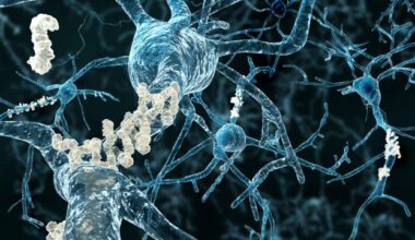 CAR T Therapy Shows Promise for Alzheimer’s Treatment