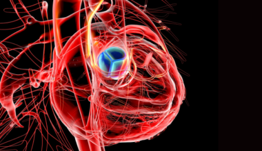 Aortic Stenosis: 200 Newly Identified Genes Raise Hope For Future Treatments