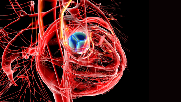 Aortic Stenosis: 200 Newly Identified Genes Raise Hope For Future Treatments
