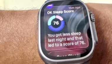 Sleep app on my Apple watch Ultra 2: An interesting update with iOS 26