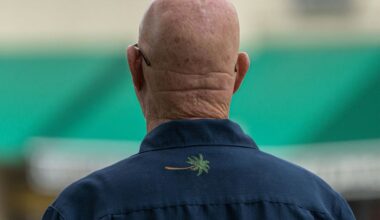 Baldness breakthrough or media hype?