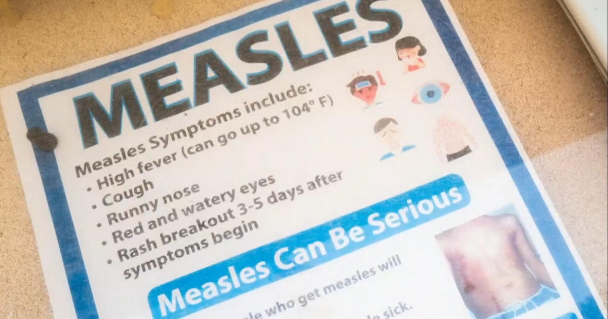As measles cases pop up in Pennsylvania, health experts have message for families