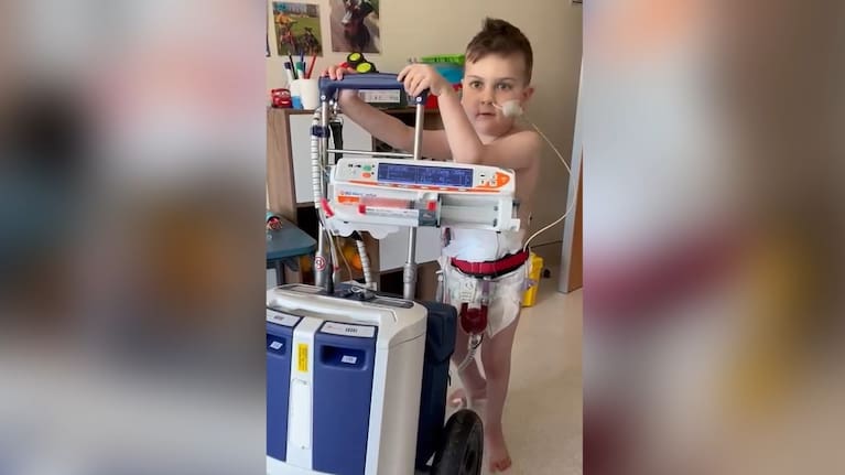 Chase attached to the Berlin heart device.