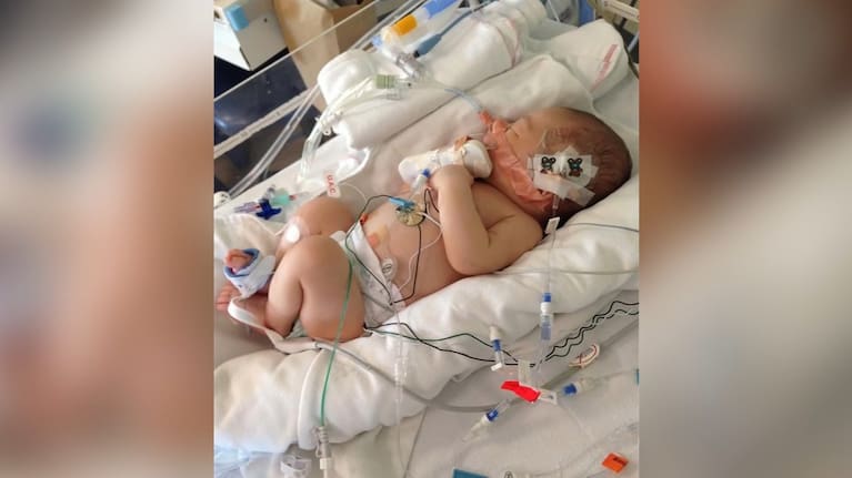 Chase was just one-month-old when he first got admitted to PICU.