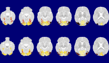 Infant brain categorizes common objects by two months of age