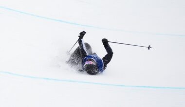 'Nothing but a scratch': Kiwi in good spirits after breaking collarbone