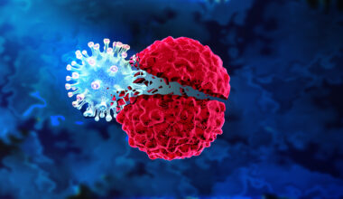 Oncolytic Virus Triggers Immune System Against Glioblastoma Cells