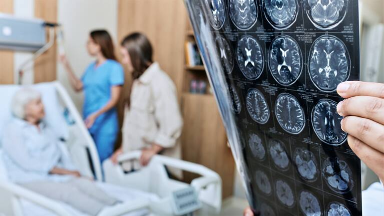 Recovery after a stroke (file image).