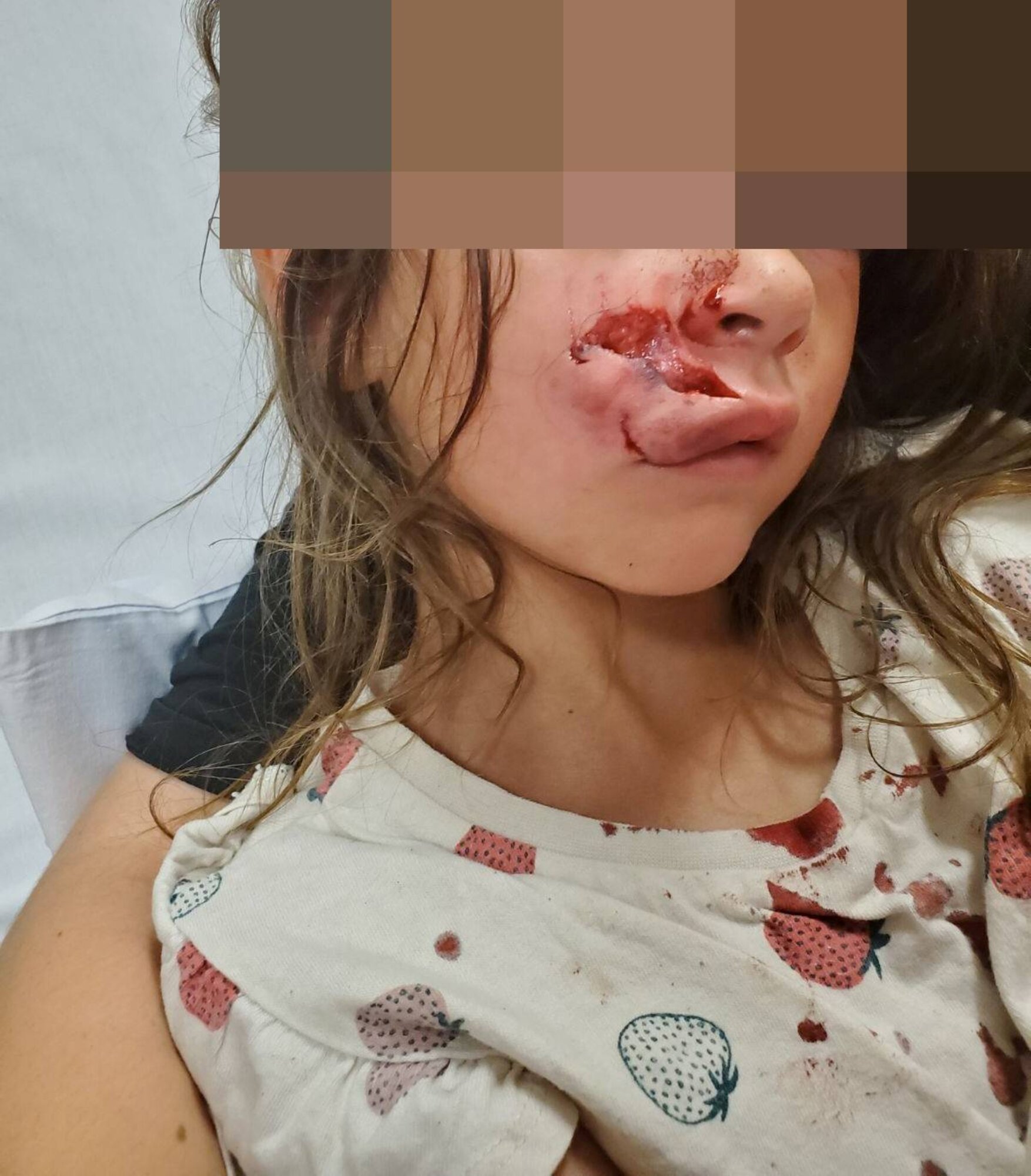  The 6-year-old was bitten by Tank, her uncle’s nine-year-old American bulldog cross, on Christmas Eve.  Photo / Supplied